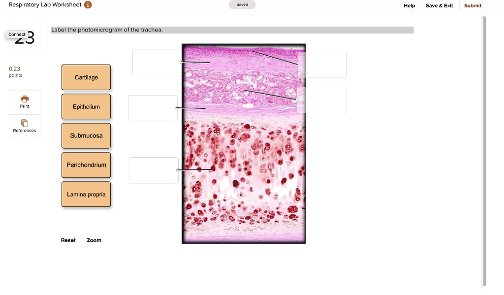 Solved Label The Photomicrograph Of The Trachea Respiratory Lab Worksheet Saved Help Save Exit