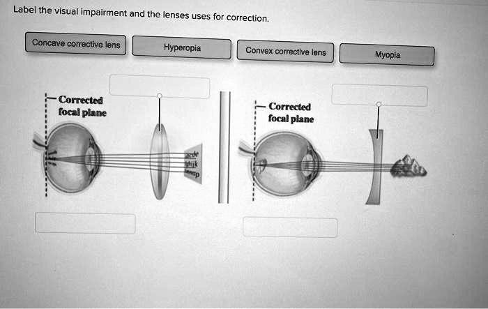 Label the visual impairment and the lenses uses for correction. Concave ...