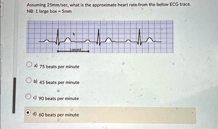 Assuming 25mm/sec, what is the approximate heart rate from the below ECG trace.
NB: 1 large box = 5mm
a) 75 beats per minute
b) 45 beats per minute
c) 90 beats per minute
d) 60 beats per minute