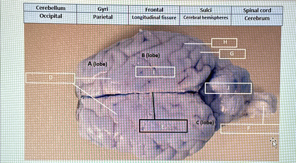 Identify the parts of the Sheep brain Cerebellum Occipital Gyri ...