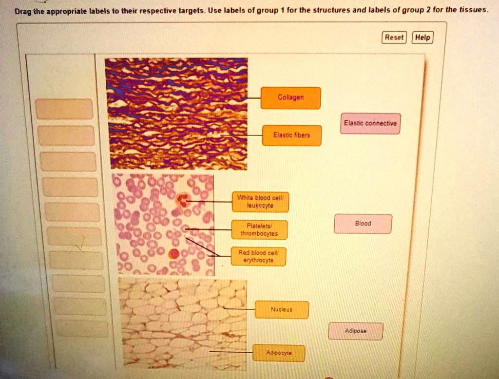 SOLVED Drag the appropriate labels to their respective targets.Use