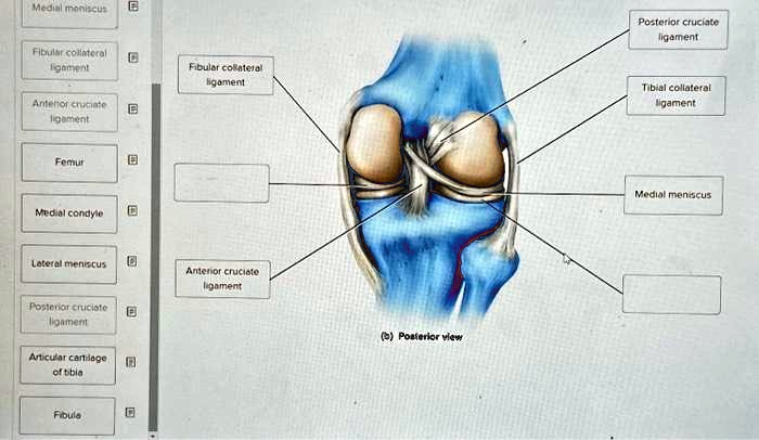 Medial meniscus Fibular collateral ligament Antenor cruciate ligament ...