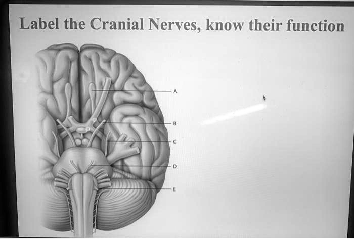 The 12 Pairs Of Cranial Nerves Cranial Nerves Body Nervous System