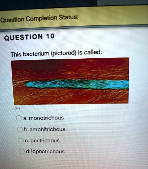 QUESTION 10
This bacterium (pictured) is called:
a. monotrichous
b. amphitrichous
c. peritrichous
d. lophotrichous