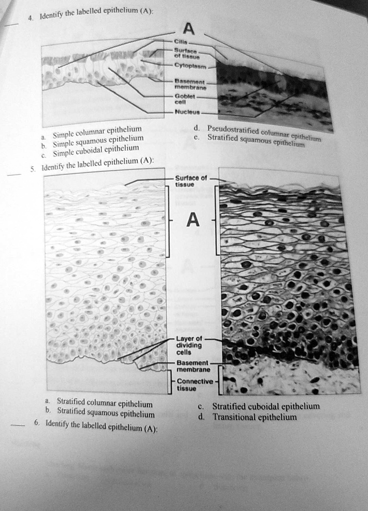Transitional Vs Simple Columnar 4. Identify the labelled epithelium (A): a. Simple columnar epithelium ...