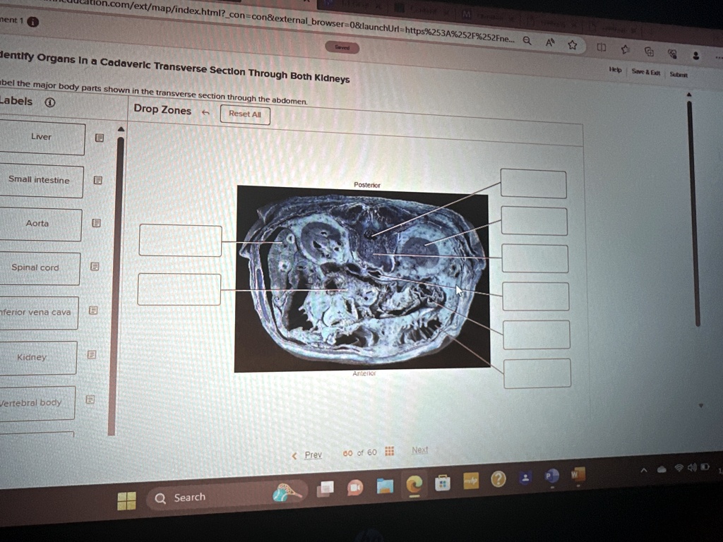 [GET ANSWER] Identify Organs in a Cadaveric Transverse Section Through ...