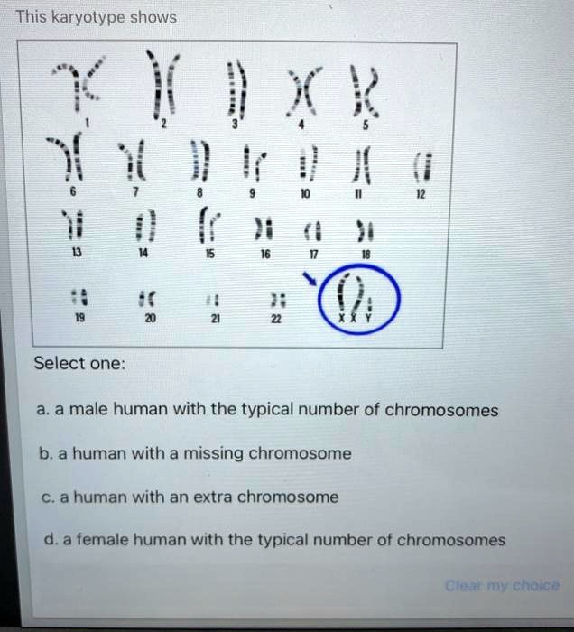 SOLVED: This karyotype shows Select one: a.a male human with the ...