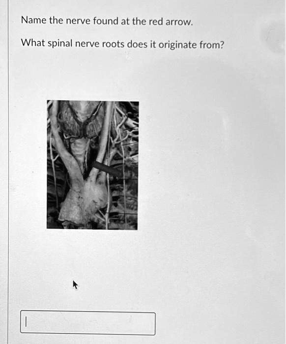 SOLVED Name the nerve found at the red arrow What spinal nerve roots