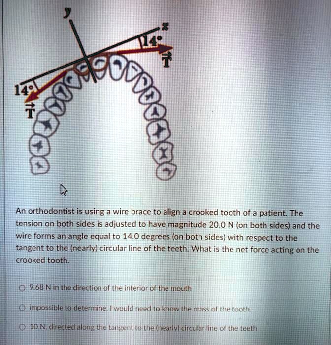 Crooked Direction SOLVED:0ai 6 An orthodontist is using a wire brace to align a crooked ...