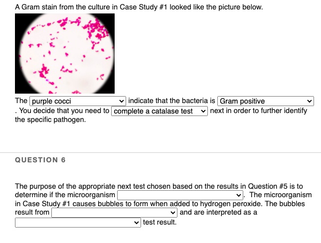 A Gram stain from the culture in Case Study #1 looked like the picture below.
The purple cocci indicate that the bacteria is Gram positive. You decide that you need to complete a catalase test next in order to further identify the specific pathogen.
QUESTION 6
The purpose of the appropriate next test chosen based on the results in Question #5 is to determine if the microorganism. The microorganism in Case Study #1 causes bubbles to form when added to hydrogen peroxide. The bubbles result from and are interpreted as a test result.
