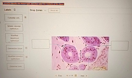 Correctly identify this tissue type and then label the features of the ...