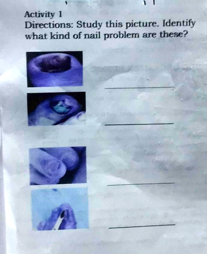 Activity 1
Directions: Study this picture. Identify
what kind of nail problem are these?