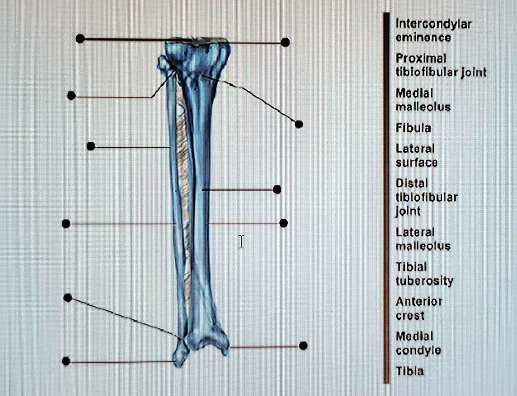 Solved: Intercondylar Eminence Proximal Tibiofibular Joint Medial 