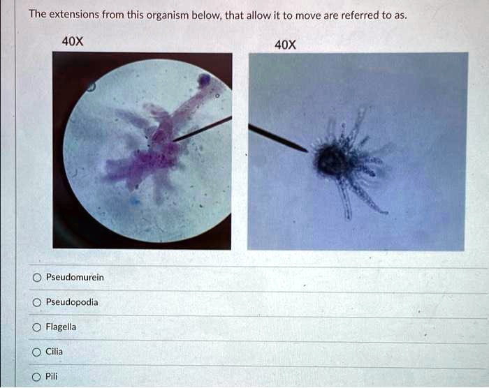 SOLVED: The extensions from this organism below, that allow it to move ...