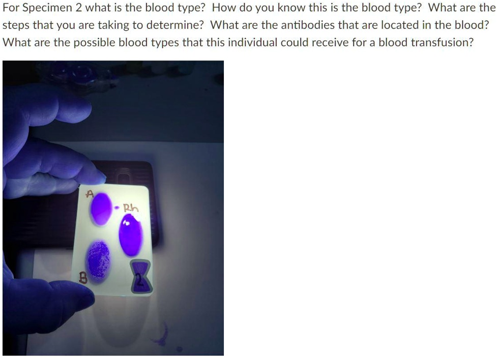 SOLVED For Specimen 2 what is the blood type? How do you know this is
