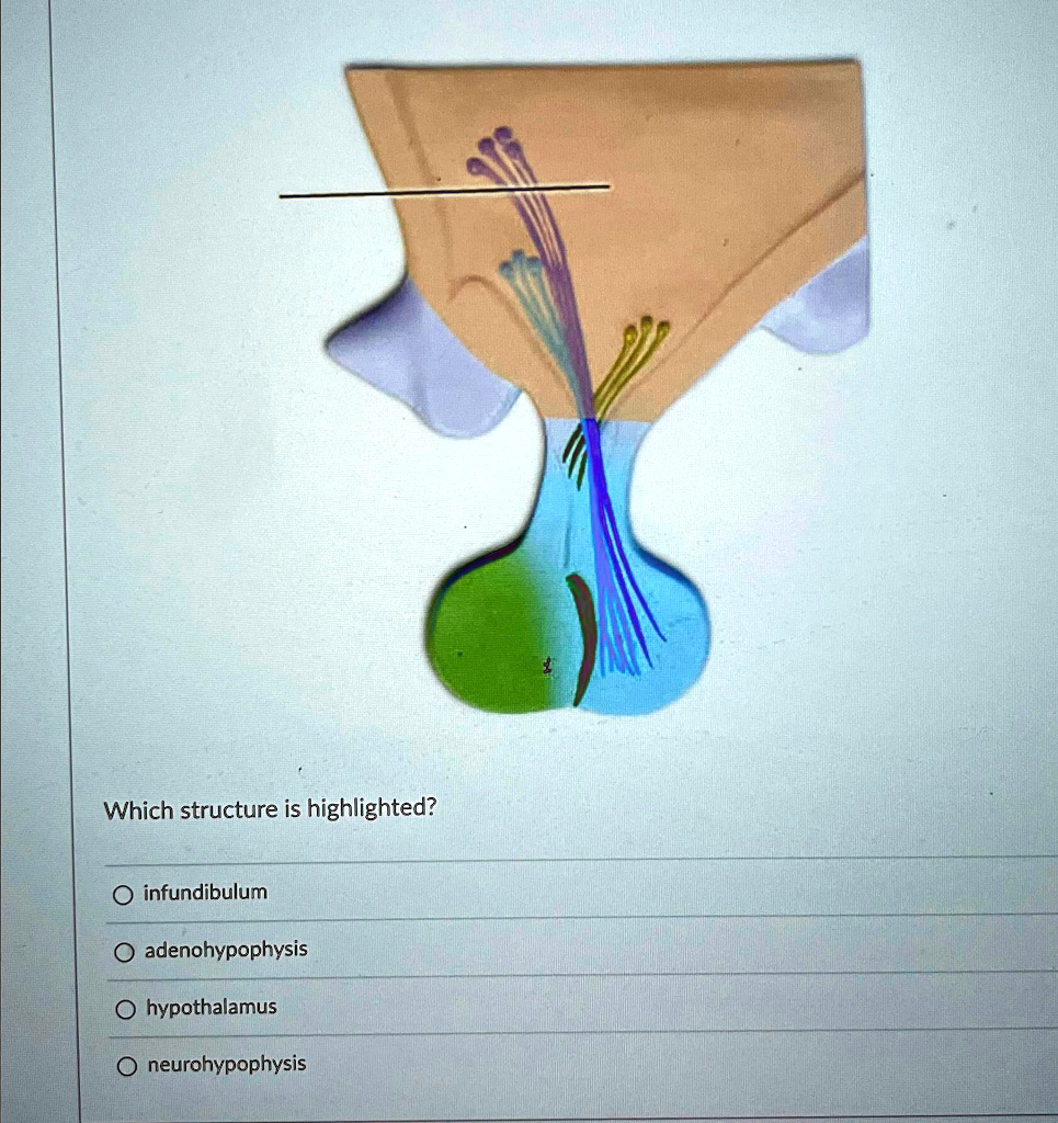 Which structure is highlighted? ? infundibulum ? adenohypophysis ...