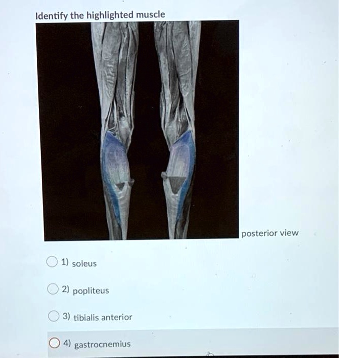 SOLVED Identify the highlighted muscle posterior view 1 soleus