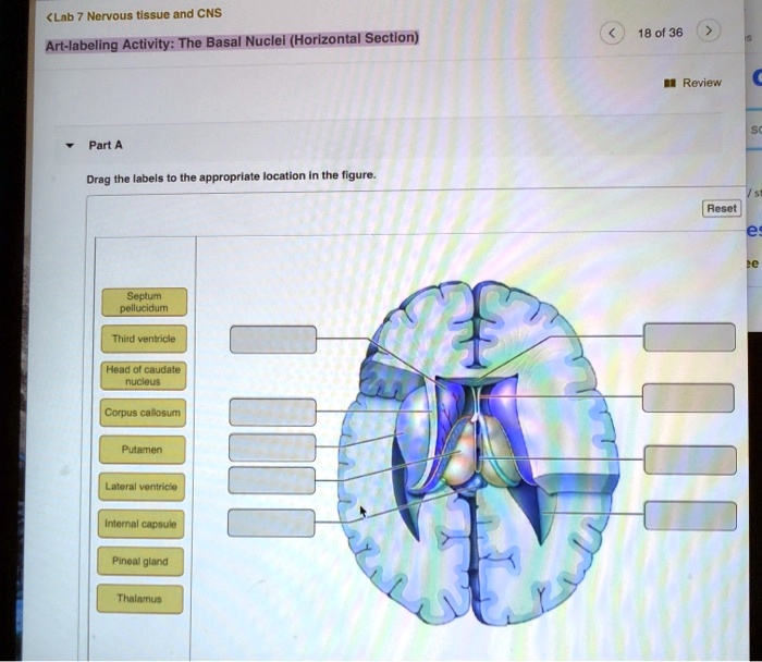 Text: Art-labeling Activity: The Basal Nuclei (Horizontal Section)