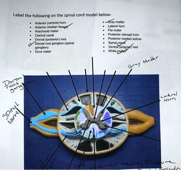 solved-anterior-ventral-horn-anterior-median-fissure-arachnoid-mater