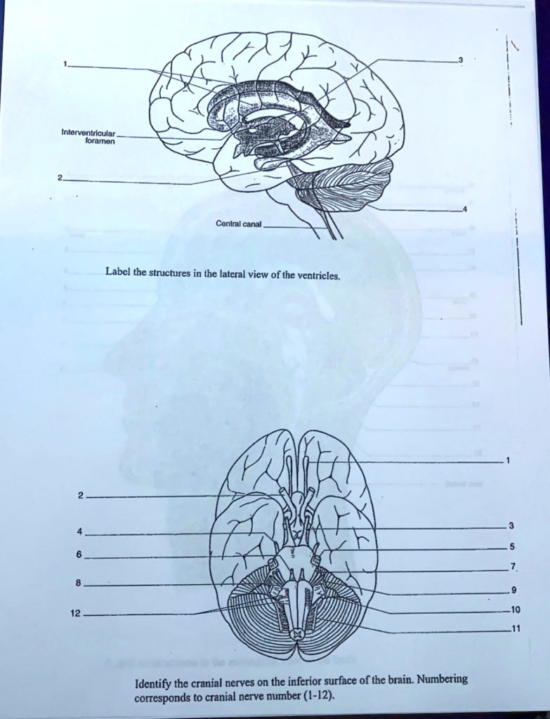 SOLVED Interventricular foramen Central canal Label the structures in