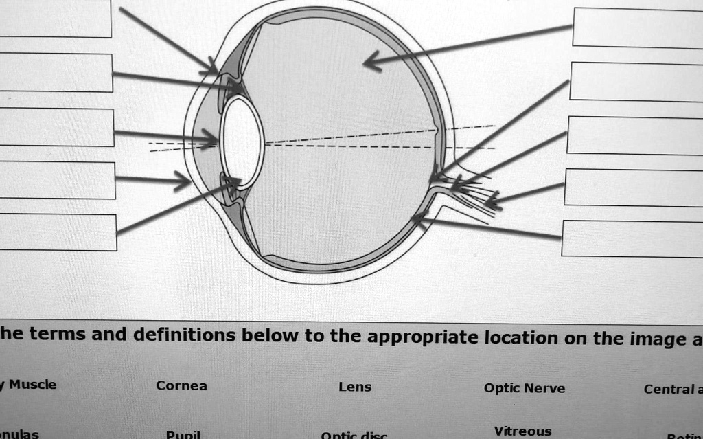 SOLVED Please label the eye with the following Ciliary Muscle Zonulas