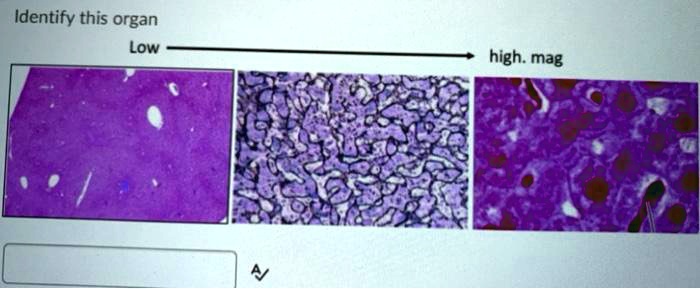 SOLVED: Identify this organ Low high. mag