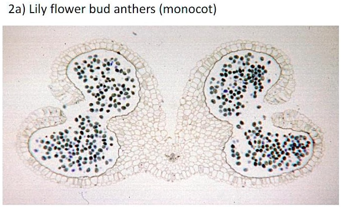 angiosperm flower prepared slides draw and label each lily flower bud ...