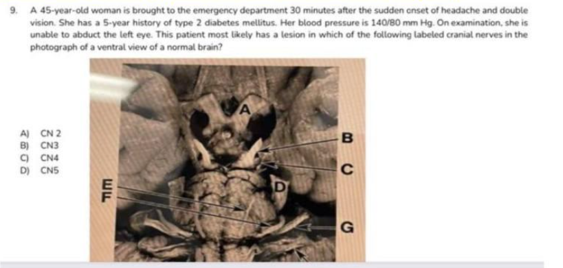 9 a 45 year old woman is brought to the emergency department 30 minutes ...