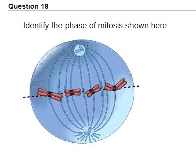 SOLVED: Question 18 Identify the phase of mitosis shown here.