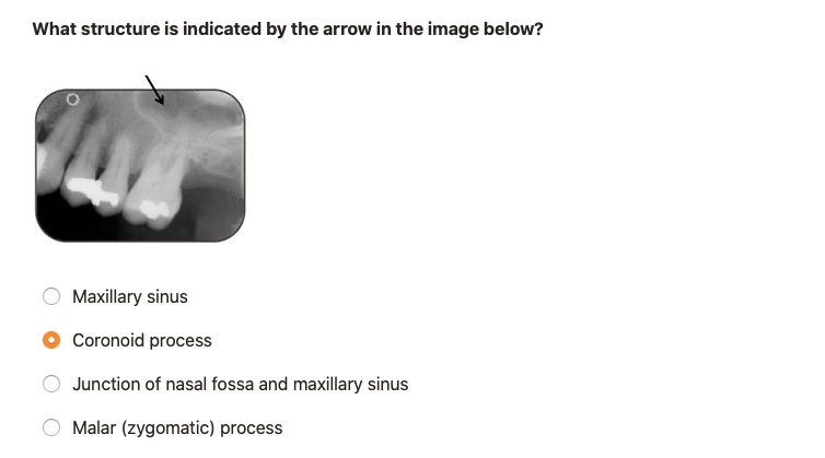 SOLVED: What structure is indicated by the arrow in the image below ...