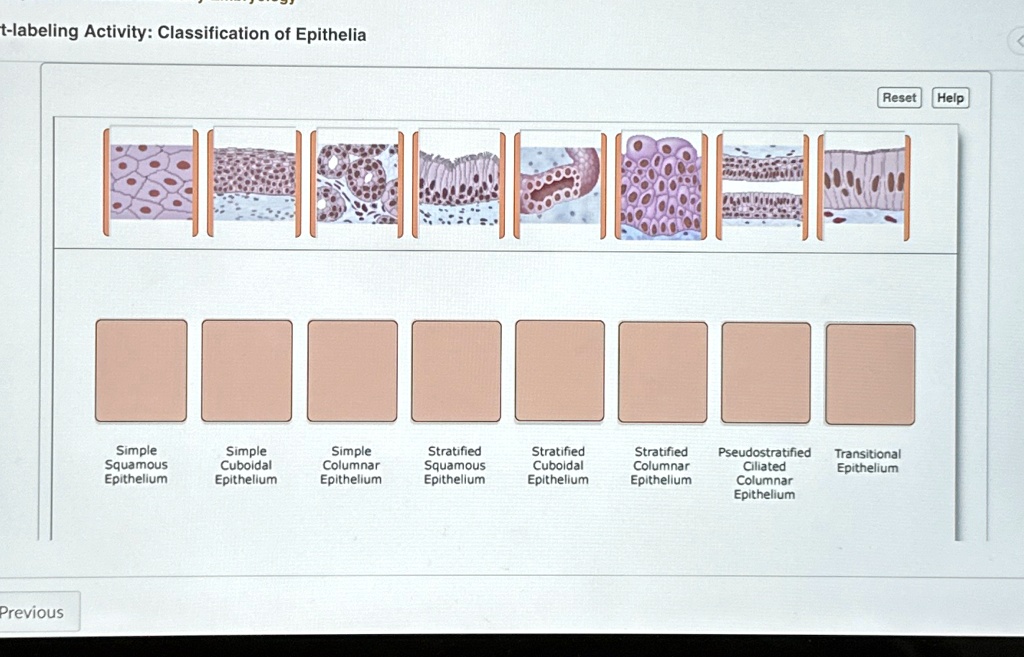 t-labeling Activity: Classification of Epithelia Help t-labeling ...