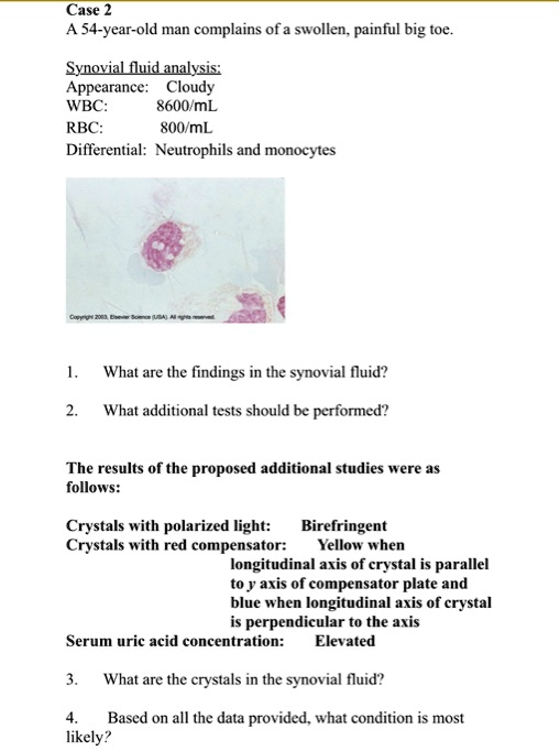 SOLVED: Case: A 54-year-old man complains of a swollen, painful big toe ...