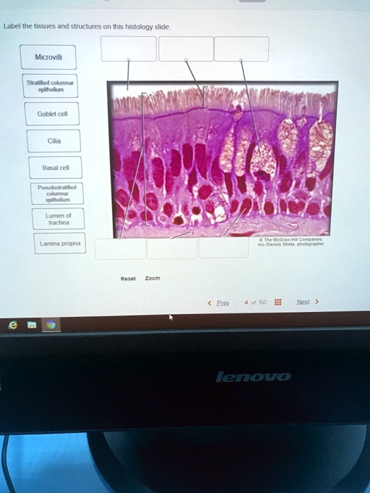 Solved Label The Tissues And Structures On This Histology Slide Microvilli Stratified