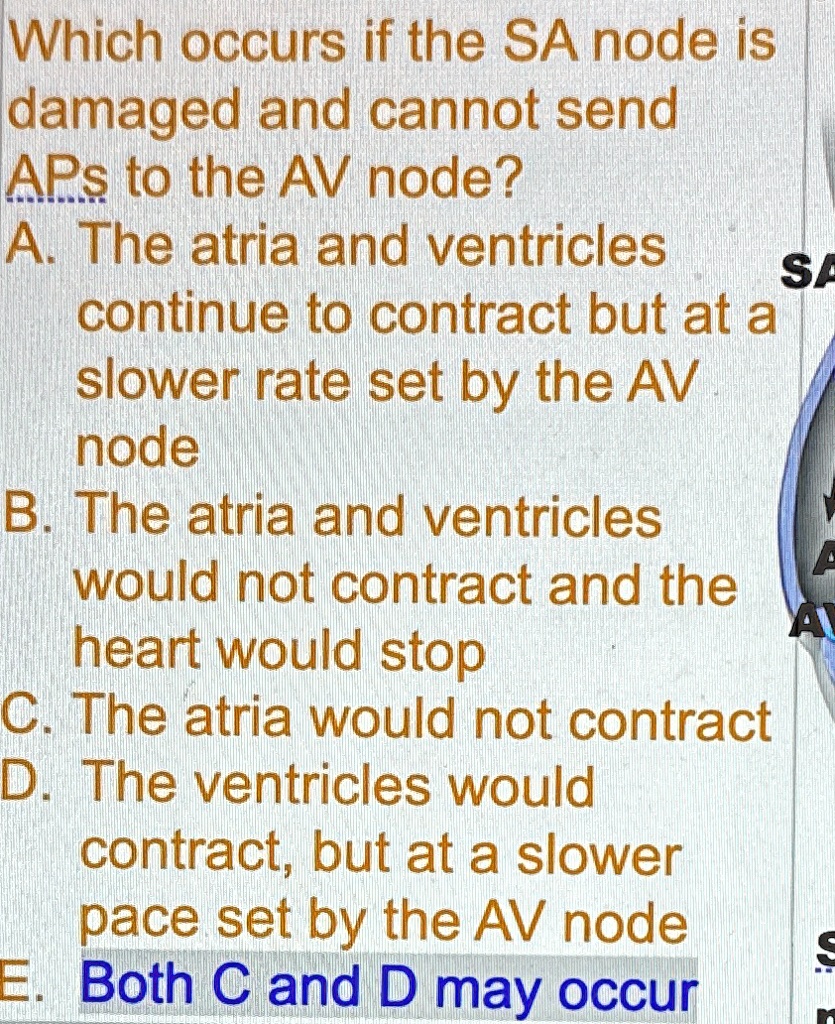 Which occurs if the SA node is damaged and cannot send APs to the AV ...