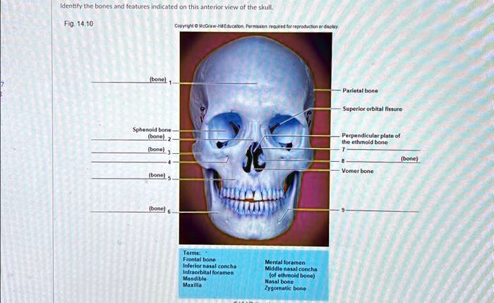 SOLVED: Texts: Identify the bones and features indicated on this ...