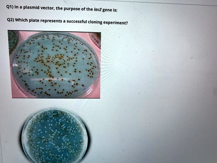 What Is The Purpose Of The Lacz Gene In A Plasmid Cloning Vector