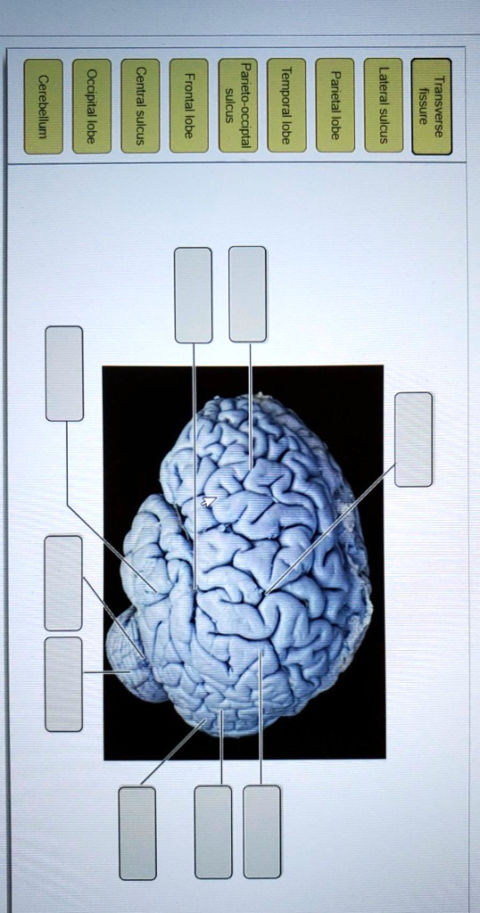 SOLVED: Cerebellum, Occipital Lobe, Central Sulcus, Frontal Lobe