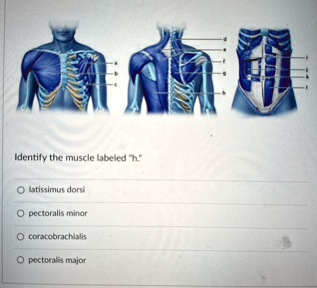 Identify the muscle labeled 