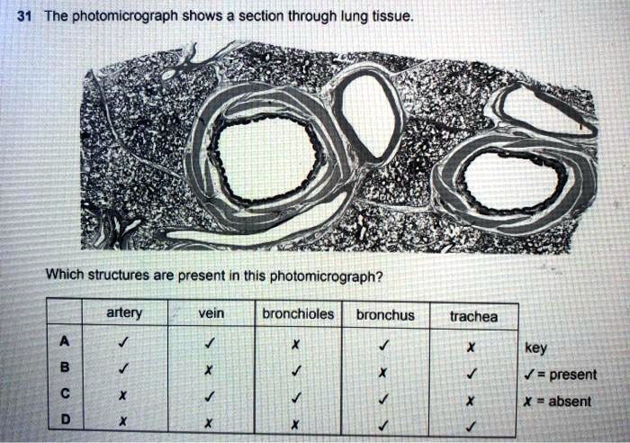 The Photomicrograph Shows A Section Through Lung Tissue Which Structures Are Present In This 3221