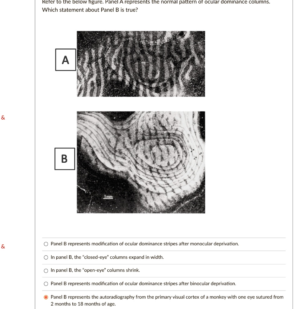 Solved Refer To The Below Figure Panel A Represents The Normal Pattern Of Ocular Dominance 4888