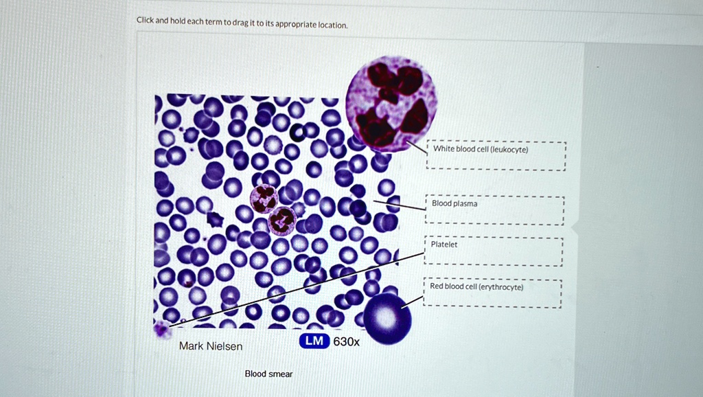 Click and hold each term to drag it to its appropriate location.
Mark Nielsen
Blood smear
LM 630x
White blood cell (leukocyte)
Blood plasma
Platelet
Red blood cell (erythrocyte)