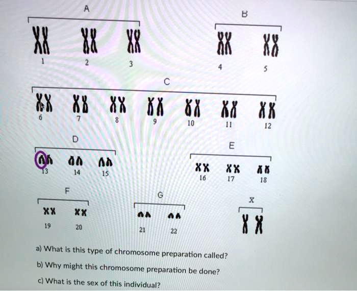 700px x 570px - SOLVED: 32 8X 8X Xk 68 Xk XX XX 16 Xx XX a) What is this type of chromosome  preparation called? b) Why might this chromosome preparation be done? c)  What is
