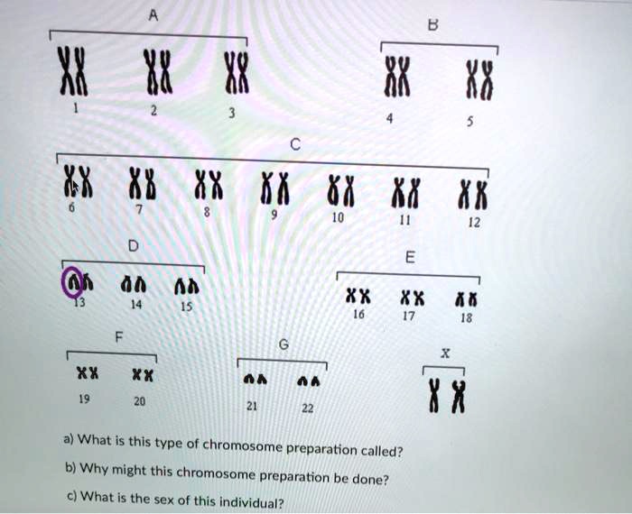 Sex Xxxxx16 Videos - SOLVED: 32 8X 8X Xk 68 Xk XX XX 16 Xx XX a) What is this type of chromosome  preparation called? b) Why might this chromosome preparation be done? c)  What is