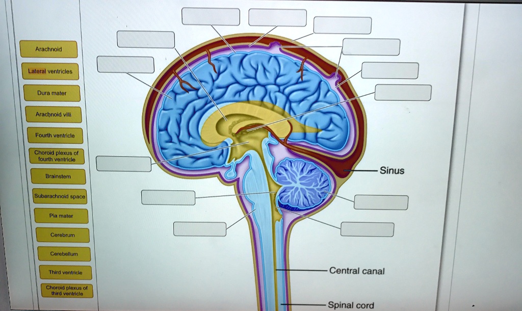 Solved: Label The Following Arachnoid Lateral Ventricles Dura Mater 