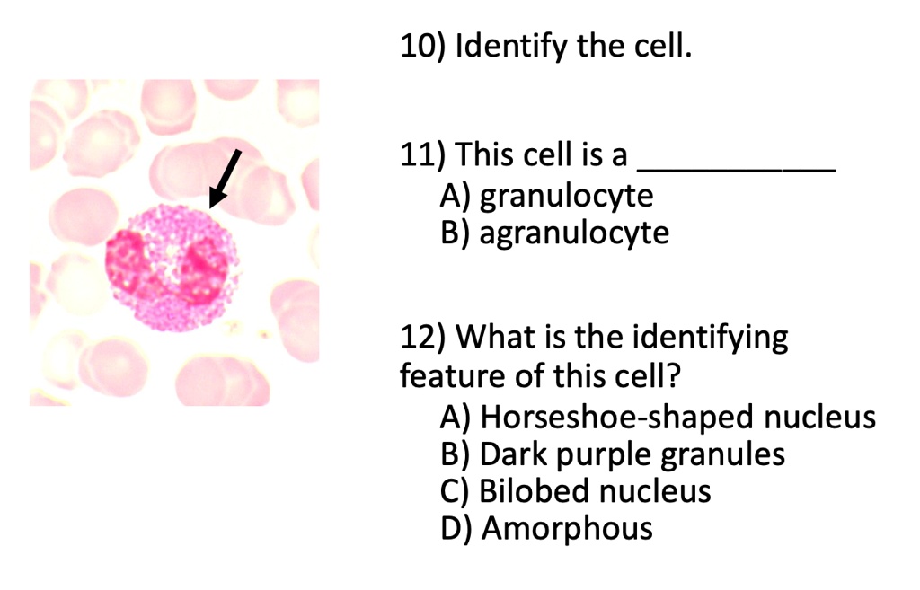 SOLVED 10) Identify the cell 11) This cell is a A) granulocyte B