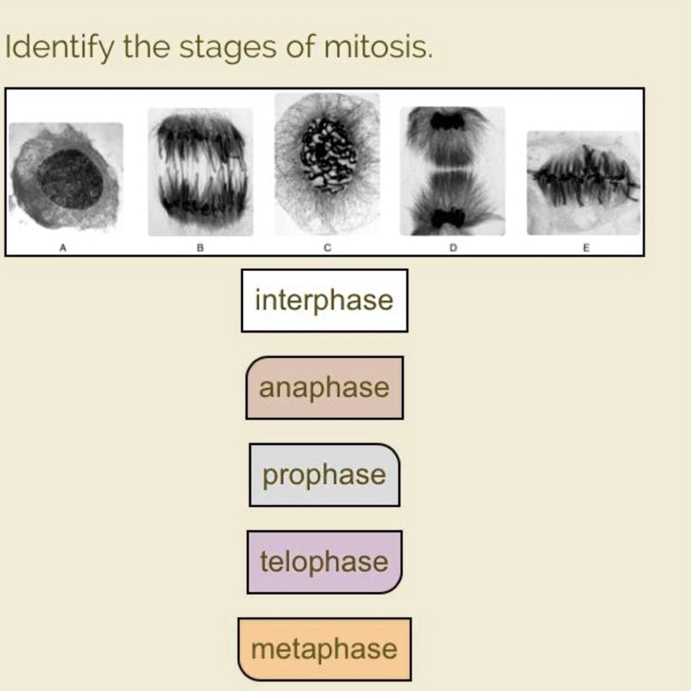 SOLVED: Identify the stages of mitosis interphase anaphase prophase ...