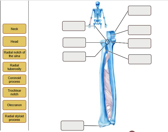 Neck Head Radial notch of the ulna Radial tuberosity Coronoid process ...