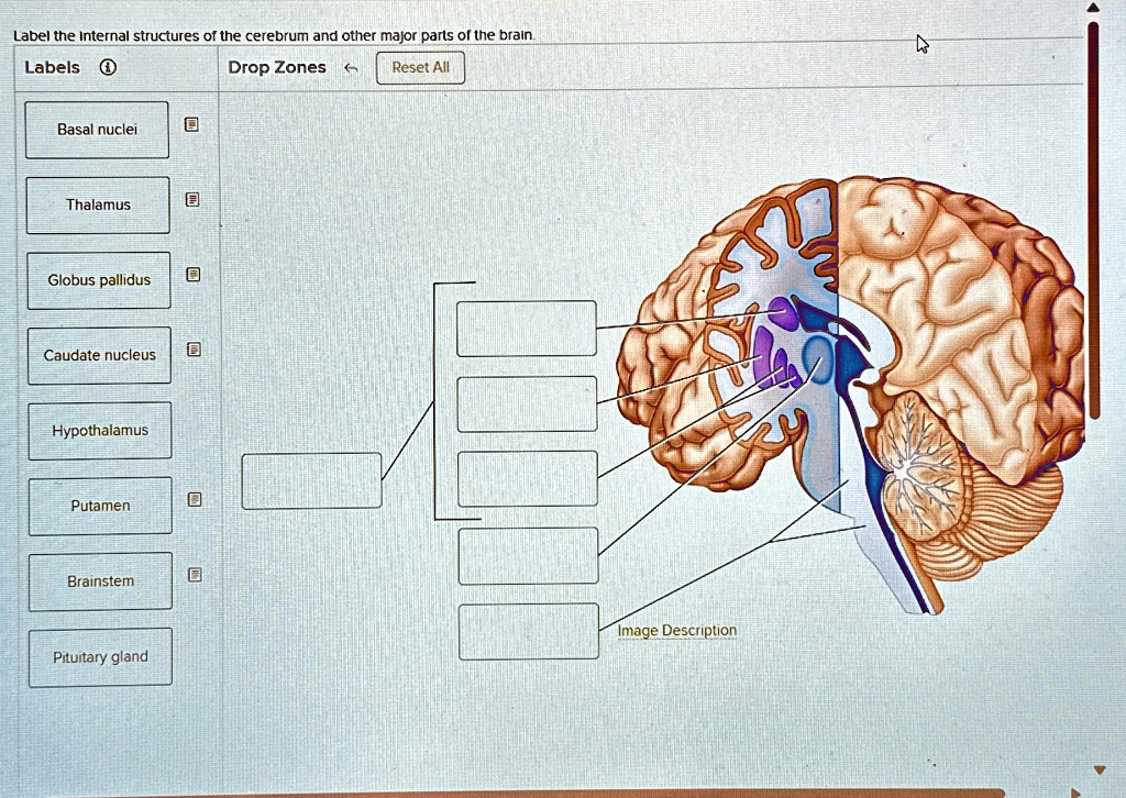 Solved Label The Internal Structures Of The Cerebrum And Other Major