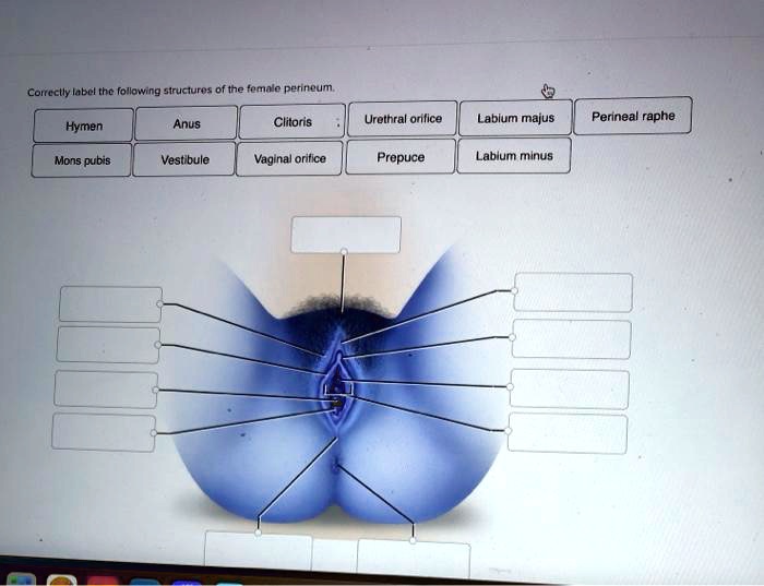 Correctly Label The Following Structures Of The Female Perineum Hymen