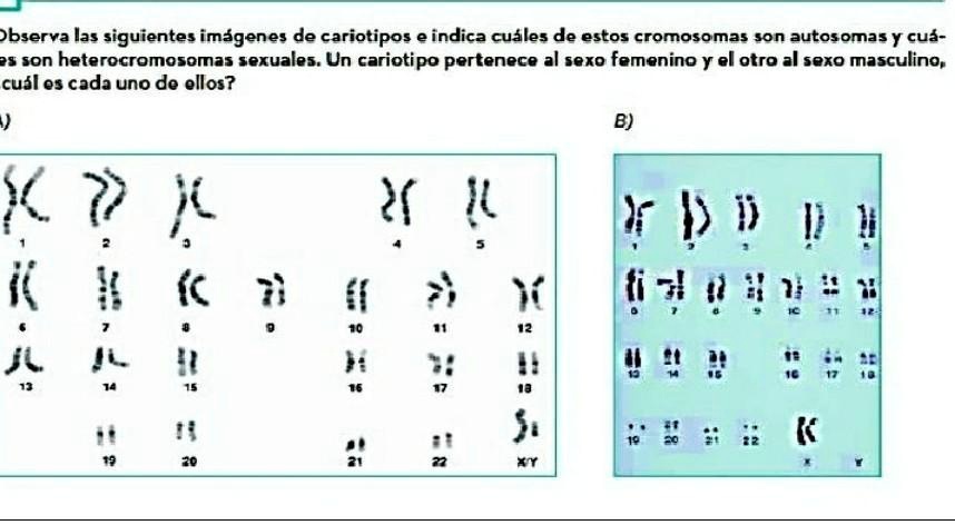 SOLVED: Observa Las Siguientes Imágenes De Cariotipos E Indica Cuáles ...